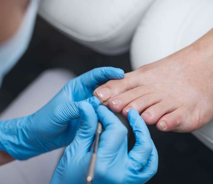 Consejos para el cuidado diario de los pies